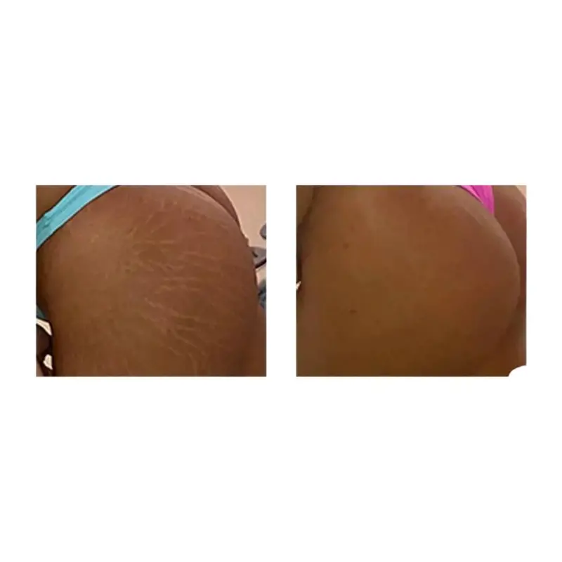 Bumbum Cream Butt Anti Cellulite / Stretch Marks 50G Beleza Brasileira 2